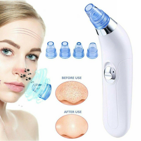 Derma Suction Vacuum Blackhead Remover Pore Cleaner- Skin Care Tool