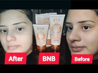 BNB Whitening Rice Extract Bright & Glow Kit (face wash|face exfoliating scrub|face mask) for skin