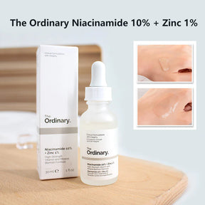 The Ordinary Niacinamide (10% + Zinc 1%) Suitable for all skin types