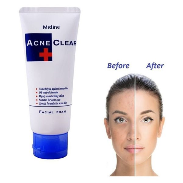 Mistine Acne Clear Face Wash Facial Foam 85 Ml