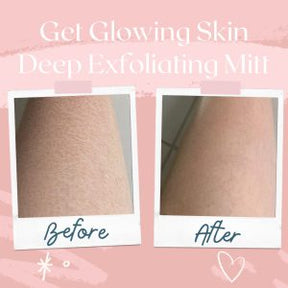 Exfoliating Gloves Dead Skin Remover